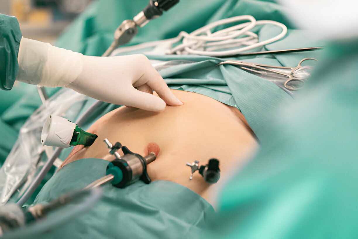 Best Laparoscopic  Surgery Doctor In Ranebennur